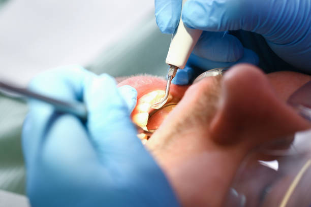 Best 24-Hour Emergency Dentist in Listoga, CA