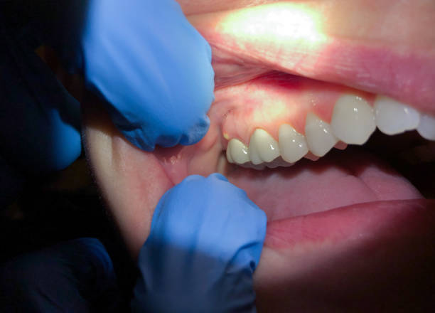 Best After-Hours Dental Trauma Care in Listoga, CA