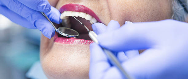 Best Emergency Gum Treatment in Listoga, CA